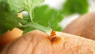 How to use celandine to remove warts